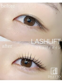 ディレット(DILETTO)/ラッシュリフト