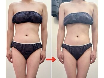 サロン ド ベル(salon.de.Belle)/インドマッサージbefore→after