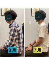 ユア(your.)/3ヶ月間の猫背矯正の評価