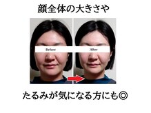 みなと/アゴ周りをシャープに