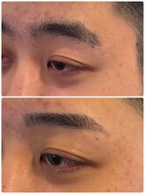 スリーピース(3Peace)/Before/After