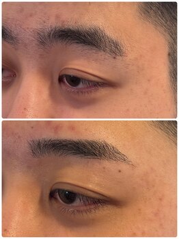 スリーピース(3Peace)/Before/After