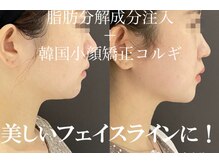 メディカルエステ ユウ(Yuu)の雰囲気（最先端！韓国美容がたくさん！）