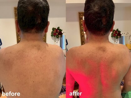 ビューティートリートメントリー 麻布十番(Beauty Treatment Ree)の写真