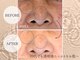 セルベッラ(cerbella)の写真