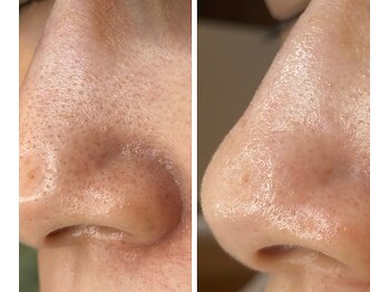 サイ(Sai)/before⇒after