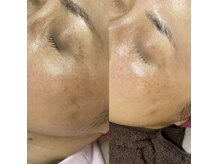 ビエン(bien)の雰囲気（ダウンタイム無し！でも深部からお肌を育てるメニューを取り揃え）