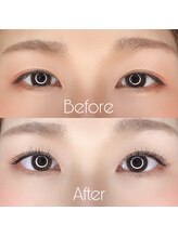 アイクイック 北千住店(Ai Quick)/ボリューム×パッチリeye♪