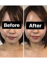 小顔コルギサロン シー(She)/【コルギ】1度の変化!