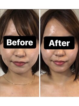 小顔コルギサロン シー(She)/【コルギ】1度の変化!