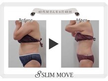 リリームーン 目黒店(Lily Moon)/痩身/スリムムーブ/目黒