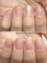 マリーロール 淀屋橋本店(Marie Laure)/自爪育成/深爪矯正/ネイルケア