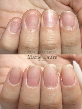 マリーロール 淀屋橋本店(Marie Laure)/自爪育成/深爪矯正/ネイルケア