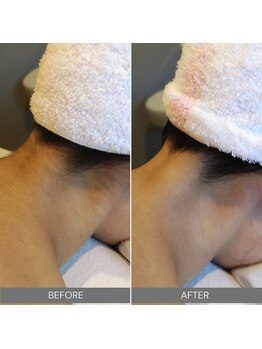 ハウオリ スパ(Hau’Oli Spa)/【ブライダルエステ】