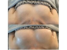 エスビューティー 三軒茶屋(S beauty)/バストケア・池尻大橋・痩身