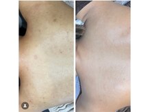 ケーナインエッセ(K9 esse)の雰囲気（結果重視！ダウンタイムありハーブピーリング！本気の肌質改善！）