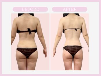 スリムライン 八戸店(The Slim Line)/before→after