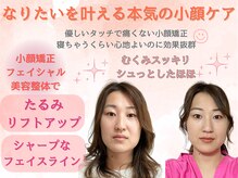 シルフィード