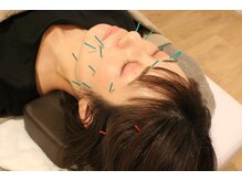 てらの鍼灸院 整体院の雰囲気（美容鍼灸に特化したスタッフが施術いたします。）