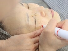 シミケア専門店 SAKURA 平塚店/平塚シミケア/伊勢店シミケア