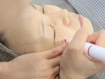 シミケア専門店 SAKURA 平塚店/平塚シミケア/伊勢店シミケア