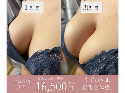 ビウラ(BIURA)の写真