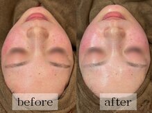 グランビューティ(Glanz Beauty)/20代女性