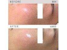 ビーミーバイライブリー(be+me by LIVELY)