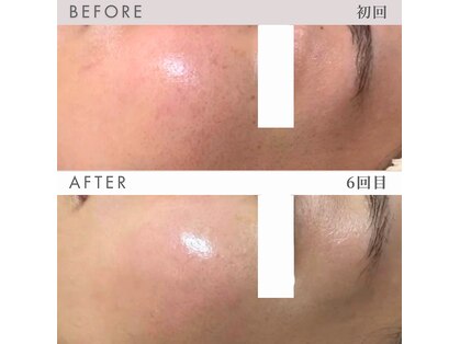 ビーミーバイライブリー(be+me by LIVELY)の写真