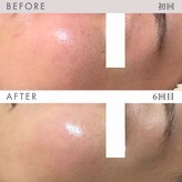 ビーミーバイライブリー(be+me by LIVELY)