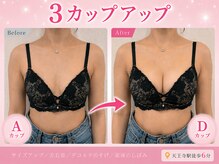 ハリスタ 天王寺院(HARISTA)の雰囲気（お悩みに合わせたバストアップ美乳鍼♪天王寺/バストアップ）