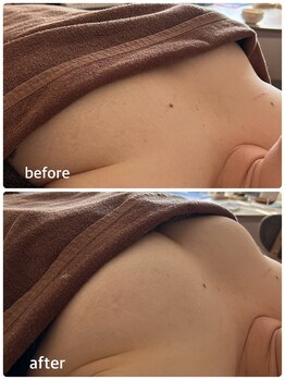 アナパナパ(anapanapa)/バストケア