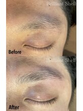 ブリリアント シェル(Brilliant Shell)/HBL☆Before→After