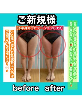 ビューティ ウィッチ(Beauty Witch)/圧倒的結果重視！