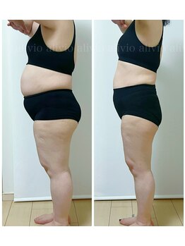 アリビオ(alivio)/ダイエットコースで-10キロ以上