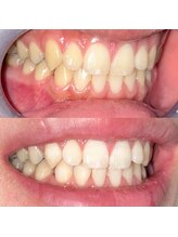 ライトビューティー 池袋店(LightBeauty)/症例写真