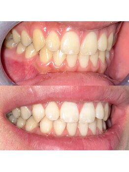 ライトビューティー 池袋店(LightBeauty)/症例写真