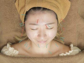 中島整骨院 鍼灸院 整体院/美容鍼