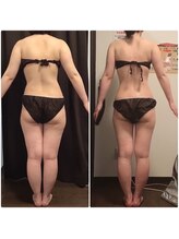 美やせ専門店 ビープロデュース 西尾店(B'PRODUCE)/【20代の方のビフォーアフター】