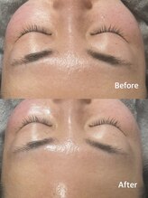 トゥインクル(Twinkle)/ハリツヤUP！毛穴改善にも☆