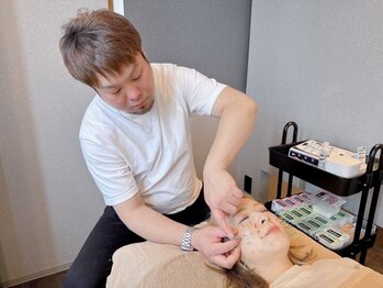 鍼灸整骨ミヤビ 札幌八軒(鍼灸整骨MIYABI)の写真/美容鍼のプロフェッショナルが、鍼で理想の姿に導く！小顔＆リフトアップ効果実感☆クマ改善も◎