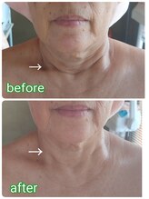 ニワ(Niwa)/バザルトフェイシャル