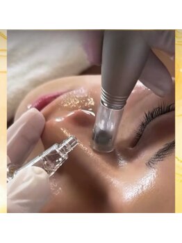 クロシェット(Clochette)/