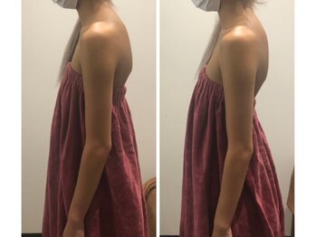 ロココ 豊田店(Rococo)/ビフォーアフター