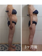 ヨサパーク モックス 堺東(YOSA PARK MOX)/６０代　週２回、３か月