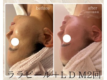 サロン ド ボーテ ラーンジュ 岐阜店(salon de beaut'e L'ange)/ララピール＆ＬＤＭ
