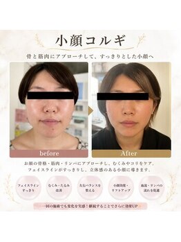 ケイビューティ(k-beauty)の写真/【韓国技！小顔アロマコルギフェイシャル¥4980】むくみや落ちてきた筋肉をしっかり引き上げリフトアップ★
