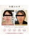 ケイビューティ(k-beauty)の写真/【韓国技！小顔アロマコルギフェイシャル¥4980】むくみや落ちてきた筋肉をしっかり引き上げリフトアップ★