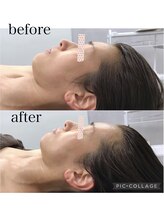 プレシャスサロン(precious salon)/1回の変化～透明感～