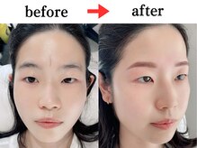 ジョリー(JOLi)/眉毛ワックス